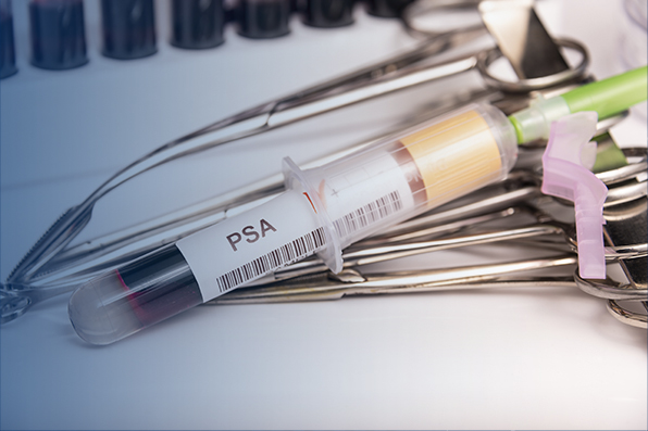 Tube containing blood to test PSA levels